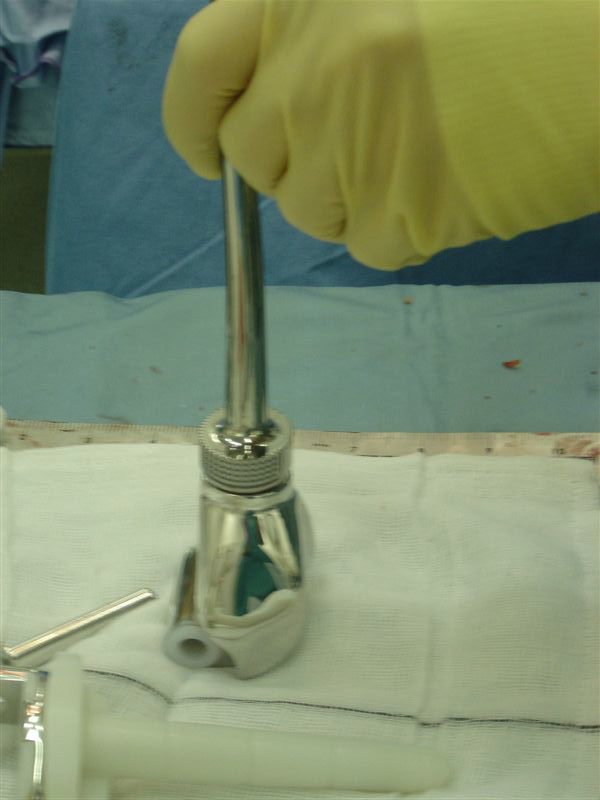 Assembled femoral component